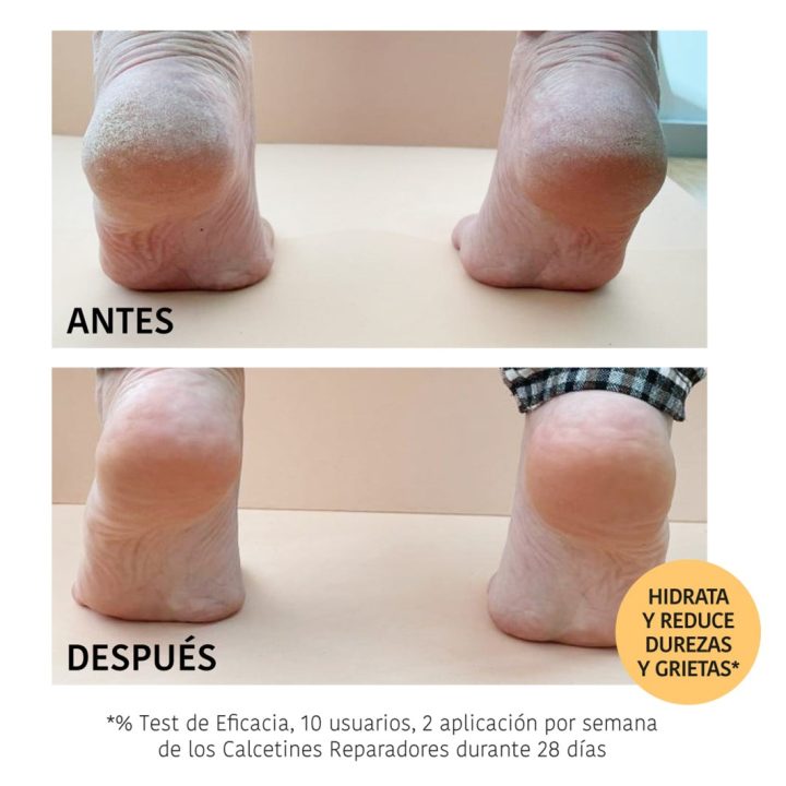 CHAUSETTE REPARATEUR PECHE